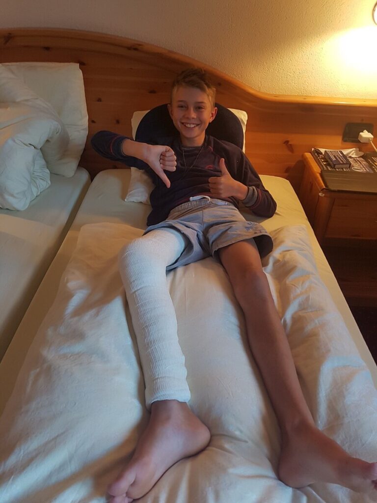 Jongetje met been in het gips